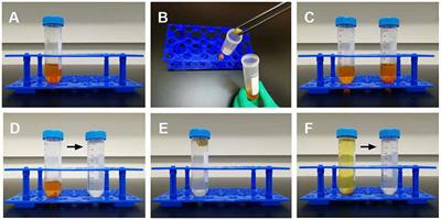 Step by Step Golgi-Cox Staining for Cryosection